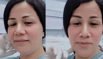 ممرضة المشرحة