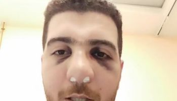 الطبيب المصاب 