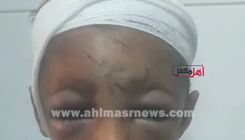 الطفل المصاب