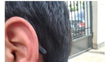 قطع أذن زميله 