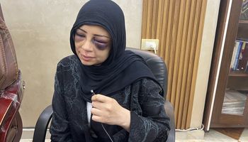 الاجهزة الامنية بمحافظة بورسعيد تلقى القبض على الشاب المعتدى على خطيبته السابفة " كوافيرة بورسعيد "