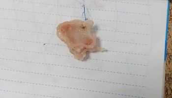 العظمة