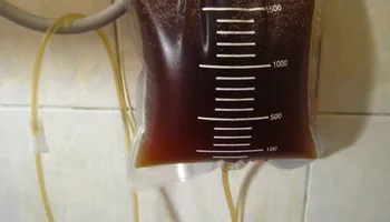 حقنة القهوة الشرجية 
