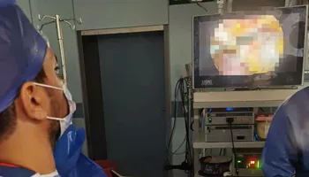 جانب من إجراء العملية 