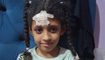 الطالبة المصابة