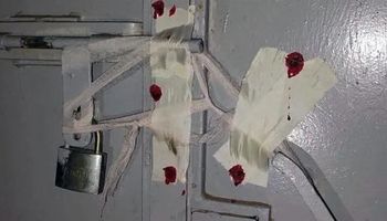 تشميع المركزالطبي الغير مرخص