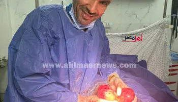 العملية 