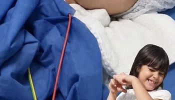 بعد صراع مع المرض وغيبوبة كاملة.. الموت يفجع أسرّة الطفلة "مكة" ضحية الكلاب الضالة في بورسعيد