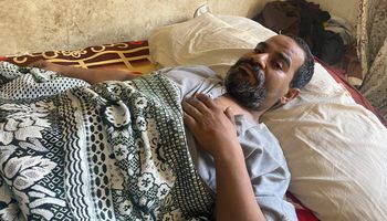دهسته سيارة أثناء عمله وبُترت قدمه.. عامل نظافة ببورسعيد يروي مأساته ويطالب بتأمين حياة أسرته"  