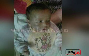 صور الرضيع الذى تعرض للتعذيب على يد والده 