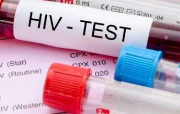  تحليل HIV 