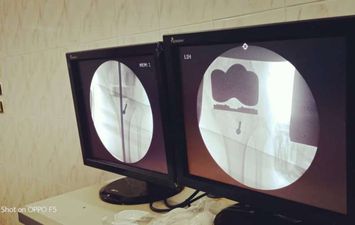 استمرار إجراء جراحات العظام بمستشفى الزقازيق العام