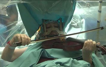  بريطانيه تعزف على الكمان أثناء خضوعها جراحة دقيقة في المخ