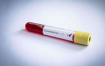 أستراليا تسجل ثاني حالة وفاة بفيروس كورونا