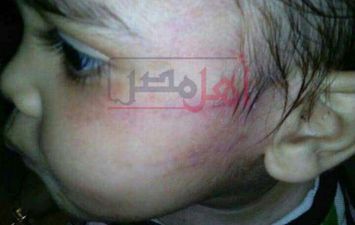 تعرض طفل للتعذيب بدار الرشاد للأيتام بالإسكندرية