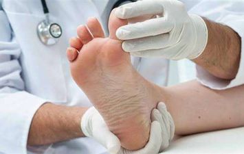 أعراض أمراض الأوعية الدموية في القدم