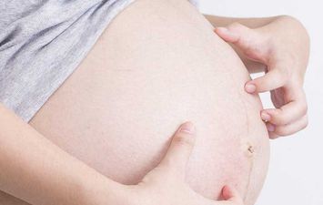 علاج الحكة أثناء الحمل