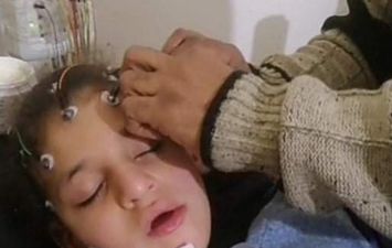 استغاثة لانقاذ الطفلة حبيبة بعملية جراحية