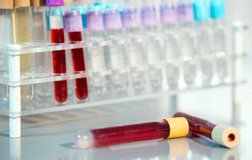 دراسة جديدة تكشف عدم وجود علاقة بين   فصيلة الدم وعدوى كورونا الشديدة