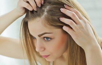 أسباب ظهور قشرة الشعر وطرق علاجها