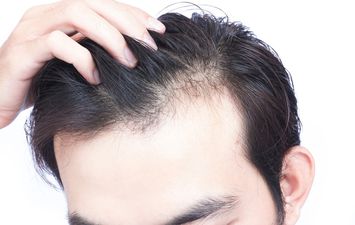 طرق علاجية للشعر الابيض ومنع تساقط الشعر