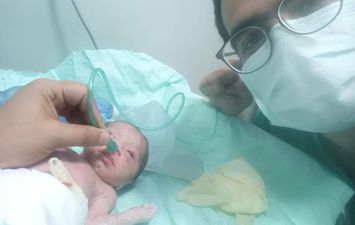 عملية جراحية للام وطفلها بجامعة أسيوط 