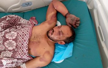 احمد حامد المصاب في ليبيا