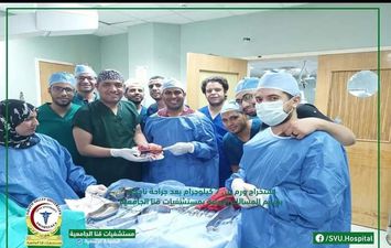 &laquo;قنا الجامعي&raquo; ينجح في إزالة ورم وزنه 7 كجم من شاب عشريني