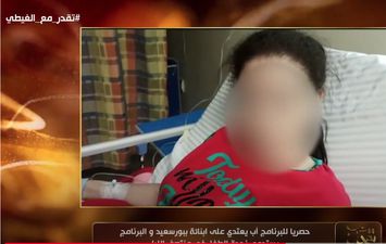 الطفلة زينب ضحية تعذيب والدها في بورسعيد