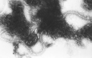 مرض الفيروس المخلوي تحت المجهر 