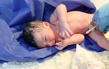 أول ولادة طبيعية بمستشفى الطور المصغر