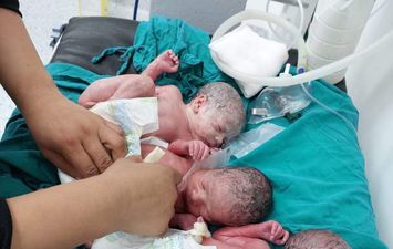 ولادة مستشفى الباجور