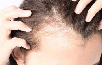 وصفات لإنبات الشعر