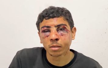 أحد ضحايا التعذيب السادي للجيش الاسرائيلي