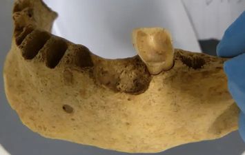 أسنان البشر القدماء 