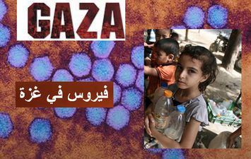 فيروس شلل الأطفال في غزة 