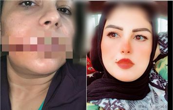 &laquo;مش هتكوني ليا ولا لغيري&raquo;.. &laquo;منى&raquo; انتقم منها طليقها على طريقة &laquo;نيرة أشرف&raquo; ببورسعيد: دمر حياتي ولسه بيطاردني