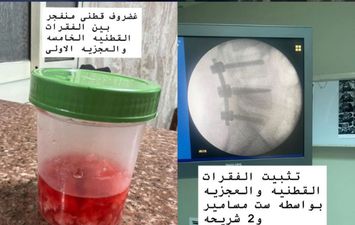 الإشاعة 