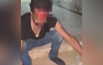 صغار يعتدون على شاب بالإسكندرية