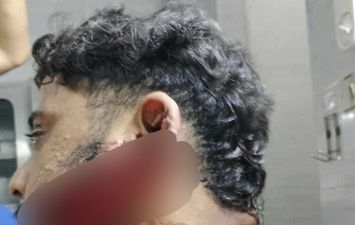 الشاب المصاب