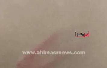 جانب من الاعتداء
