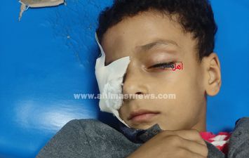 الطفل عمر ياسر 