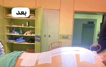 المريض بعد إجراء العملية 