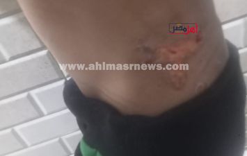 احد الابناء المعتدى عليهم 