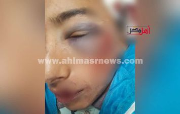 الطالب المعتدي عليه 