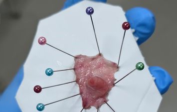 جانب من العملية الجراحية 