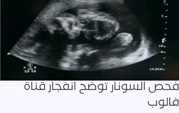 جانب من الأشعة الخاصة بالمريضة 