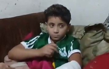 أكل قطع من ايده &hellip;. القصة كاملة لعقر كلب لطفل بمحافظة بورسعيد