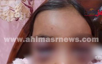 صور الطفلتين