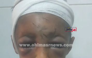 الطفل المصاب